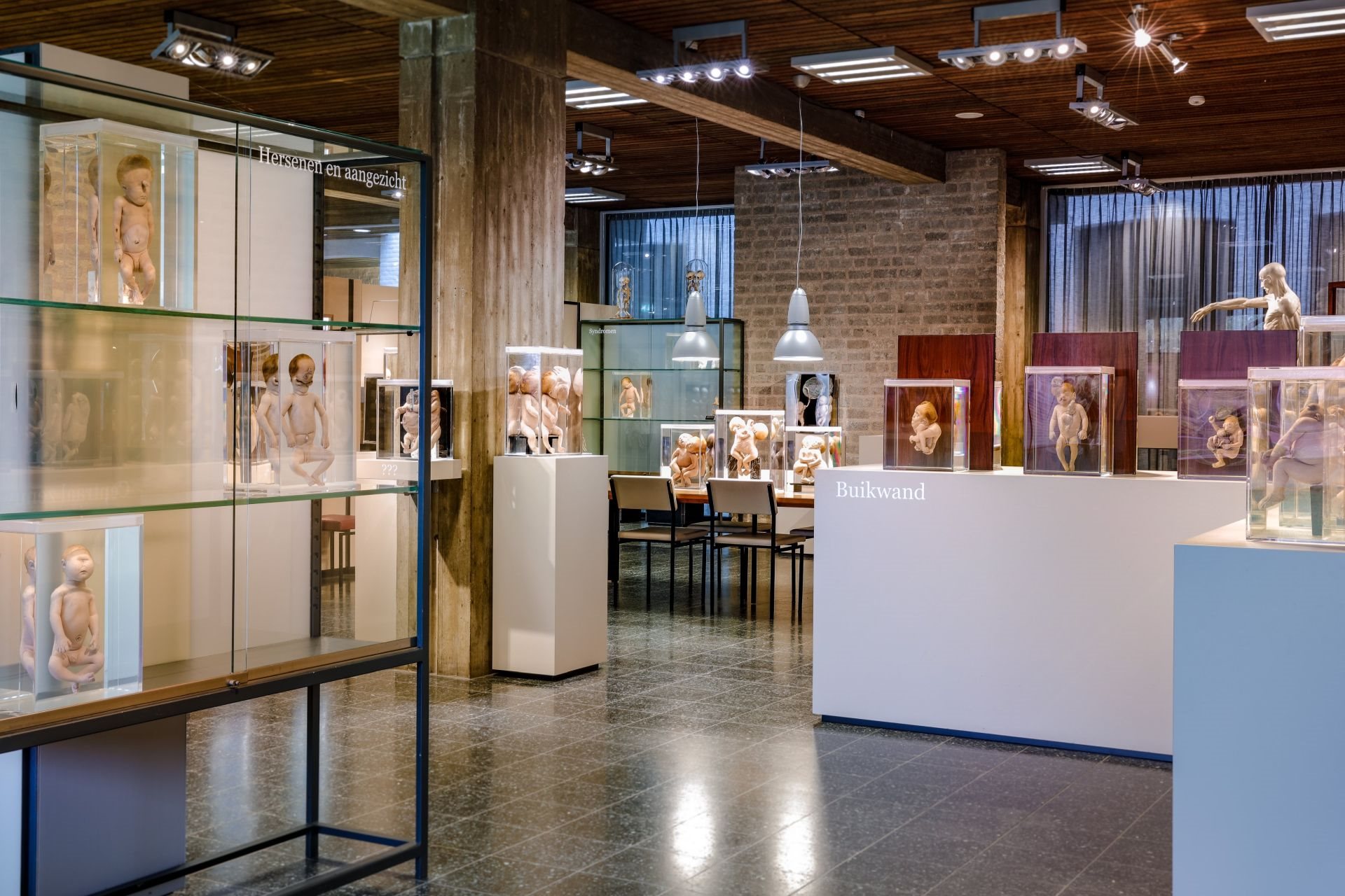 Foto bij Museum voor Anatomie en Pathologie